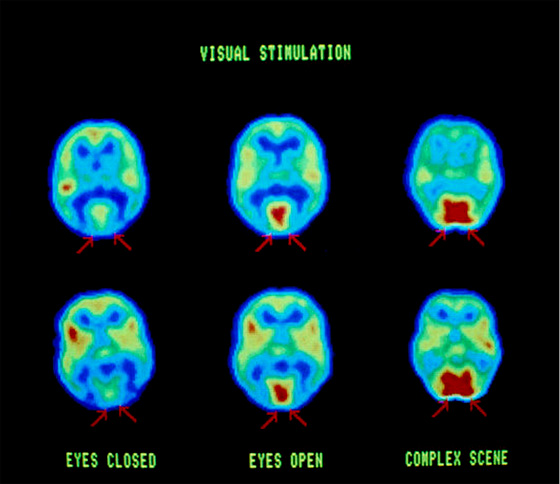 Активность мозга при различных зрительных стимулах